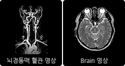 뇌경동맥 brain 영상